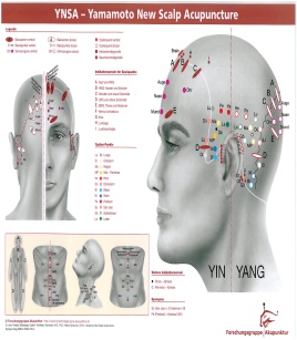 YNSA Schädelakupunktur Schreibtischauflage
