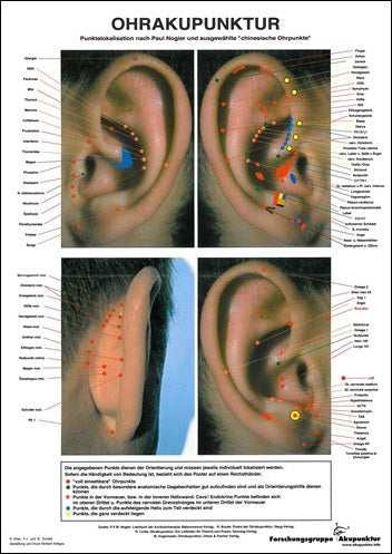 Ohrakupunktur Ordnerposter