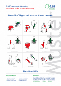 Poster Triggerpunkt-Akupunktur Obere Körperhälfte