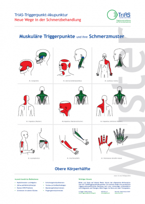 Poster Triggerpunkt-Akupunktur Obere Körperhälfte