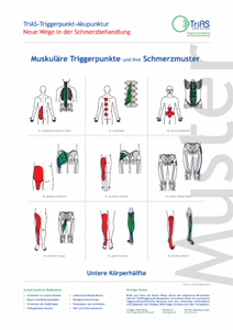 Poster Triggerpunkt-Akupunktur Untere Körperhälfte